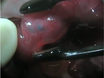 In Utero Intraventricular Injection and Electroporation of E15 Mouse Embryos thumbnail